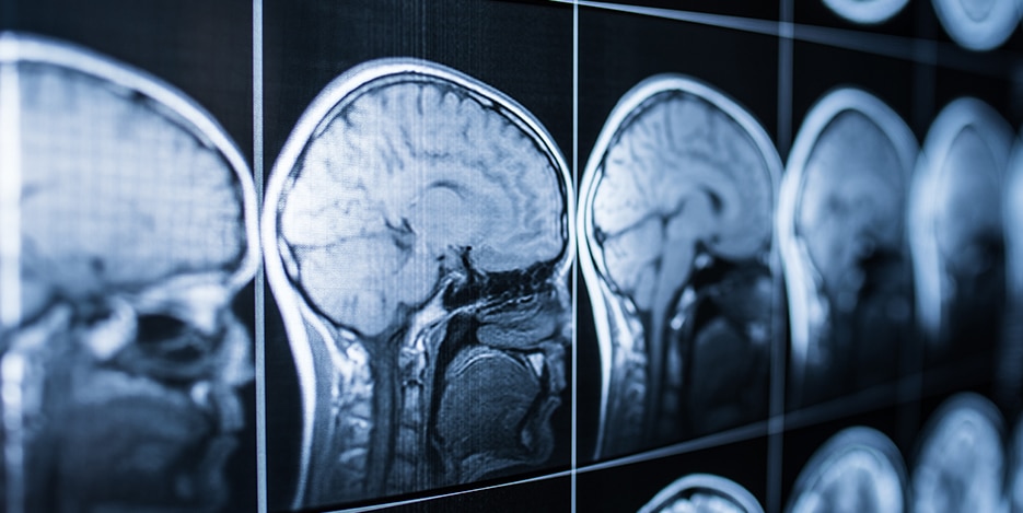 Hartford Traumatic Brain Injury Attorneys Hartford Traumatic Brain Injury Attorneys